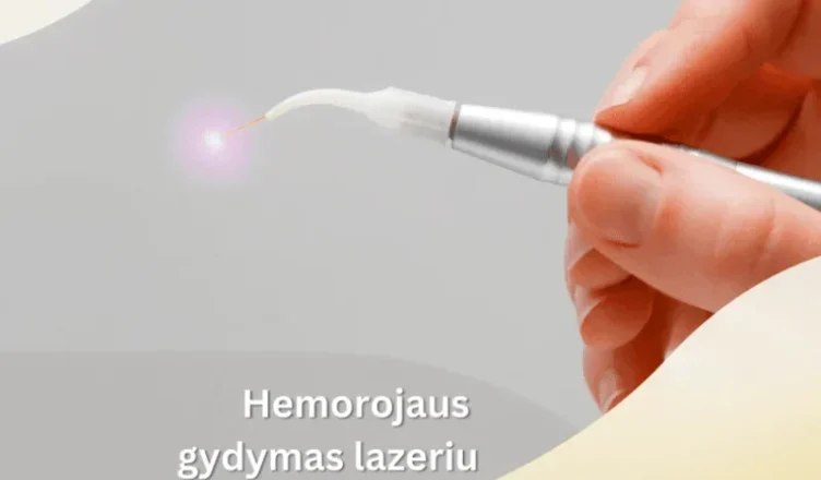 Hemorojus kelionėje