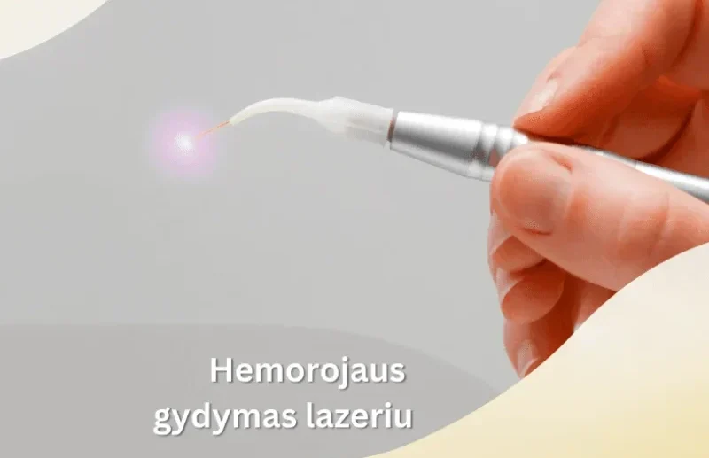 Hemorojus kelionėje